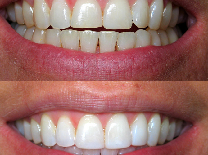 client 2 dental work