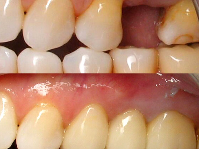 client 3 dental work